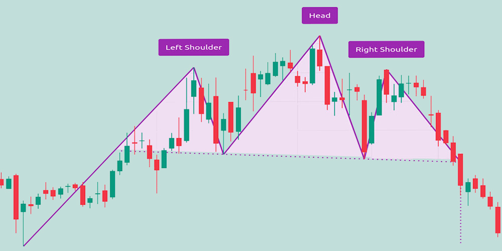 الگوی سر و شانه